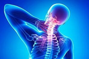 sakit belakang sebagai gejala osteochondrosis