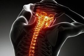 sakit pada osteochondrosis