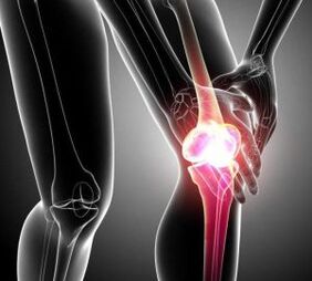 sakit lutut pada artritis dan arthrosis