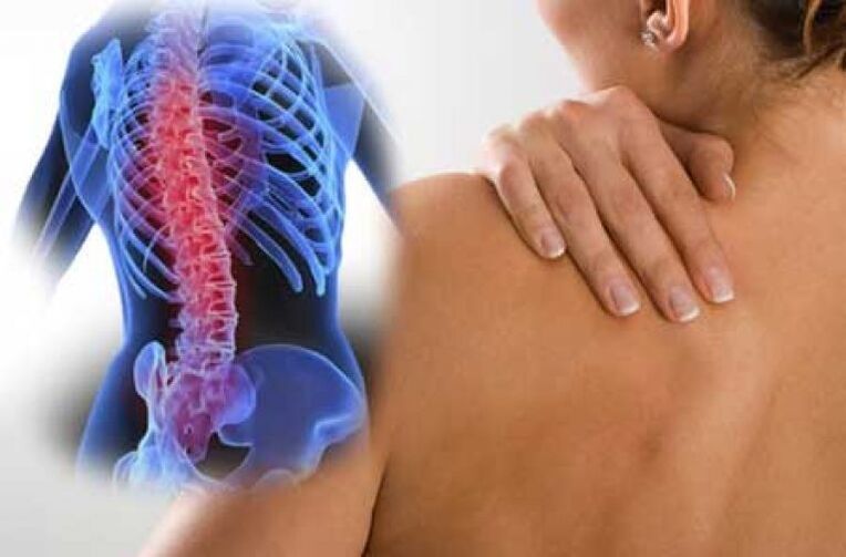 Semasa pemburukan osteochondrosis tulang belakang toraks, sakit dorsago berlaku