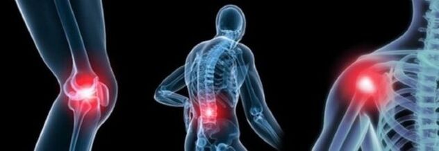 Jenis kesakitan dengan arthrosis