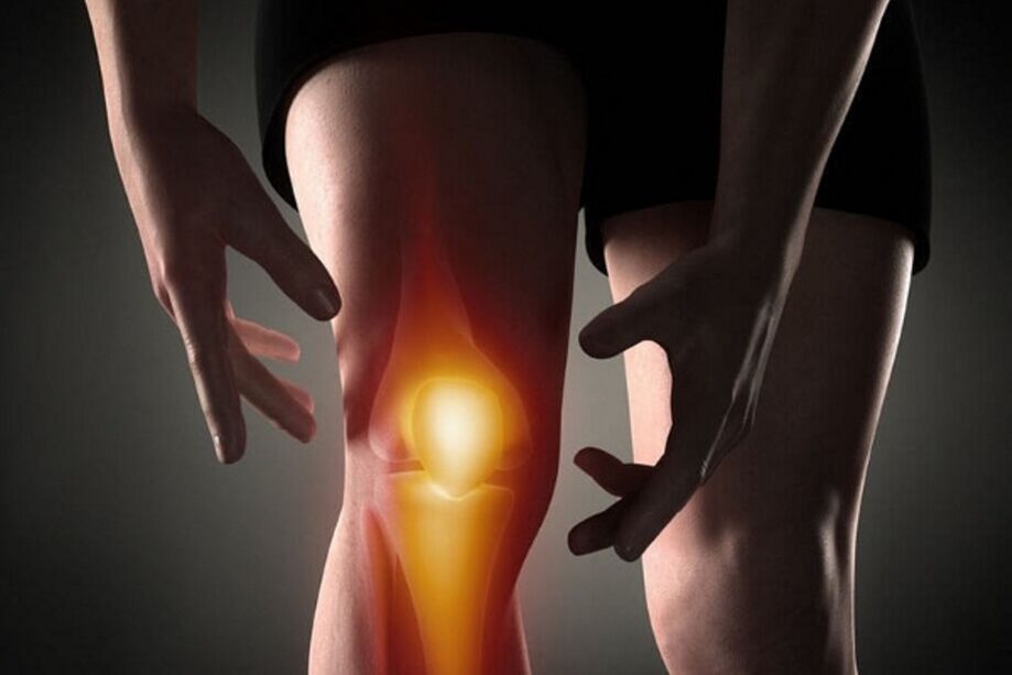 Dengan arthrosis, kesakitan menjadi lebih kuat semasa pergerakan
