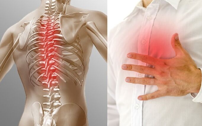 Osteochondrosis toraks ditunjukkan oleh rasa sakit dan rasa sesak di dada
