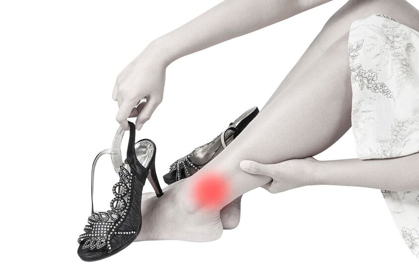 sakit pada sendi buku lali akibat arthrosis